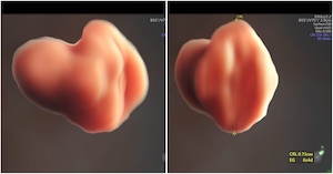 5-8-mm-embryo-embryo.JPEG