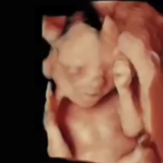 dans-fetus.png