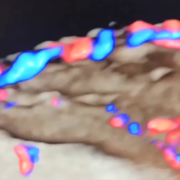 fetus-anatomy.png