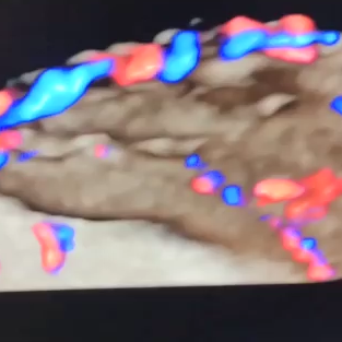 placenta.png