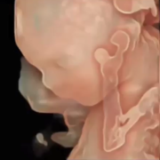 prenatal-images.png