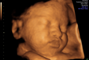 vc-ge-32w4d-3635-3d-face.png
