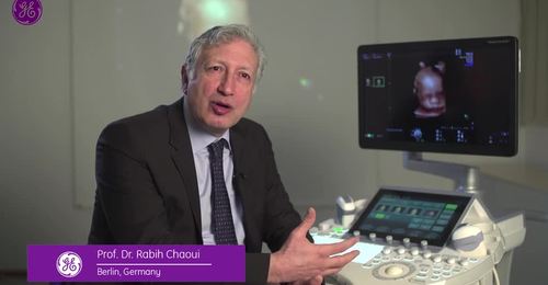 Voluson Real-time 4D imaging w/e4D Education video featuring ...