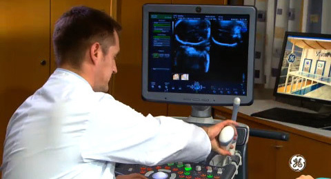 Voluson Signature Series: 3D acquisition of the fetal brain