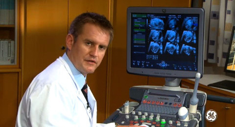 Voluson Signature Series: 3D acquisition of the fetal trunk