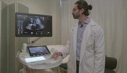 Anatomía normal del compartimento anterior en 2D