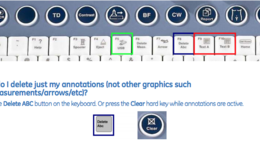 Voluson E-Series FAQs