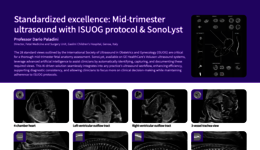 ISUOG views using Voluson SonoLyst AI tool