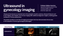 Benefits of ultrasound technologies in GYN diagnosis