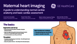 Maternal heart imaging – Apical 4-chamber