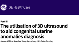 The utilisation of 3D ultrasound to aid congenital uterine ...