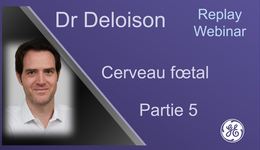 Cerveau fœtal: Ventriculomégalies et gyration Webinar FR