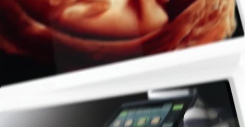 ISUOG 2016 Scientific Symposium: Dr. Benacerraf, Paladini & Benoit