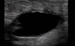 Elements Of Breast Imaging Basics