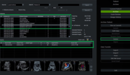 Voluson Expert Series - Image Management 