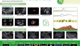 Infertility Poster (EN)