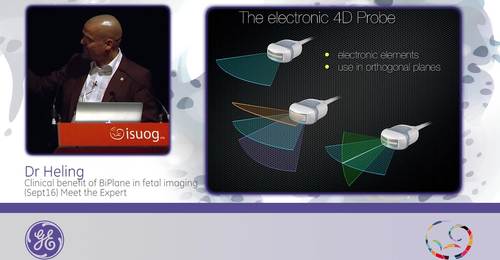 ISUOG 2015 - Dr. Heling: Clinical benefit of BiPlane in fetal imaging