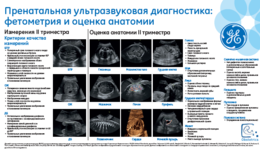Obstetrics II Trimester (RU)