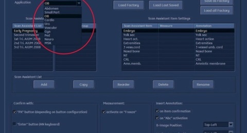 Application Tips & Tricks: How to set up Scan Assistant