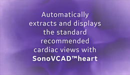 SonoVCAD heart