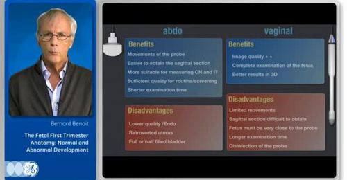 VISUS 2015:  Dr. Benoit- The Fetal First Trimester Anatomy: ...