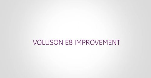 Dr. Benoit: Voluson E8 Improvement
