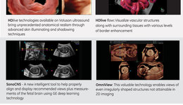Voluson Expert Series - Flyer #1 (PDF)