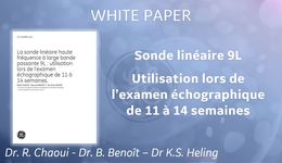 Sonde Linéaire au 1er Trim WP Obst FR
