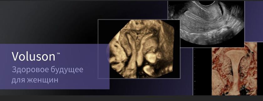 voluson-banner-ru.JPG