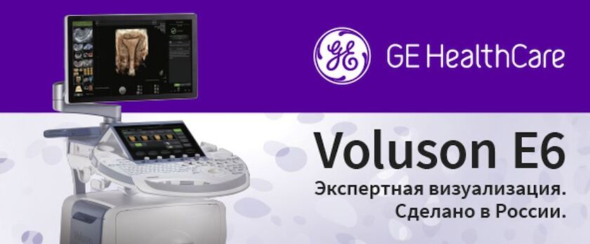 voluson-e6-ru.JPG